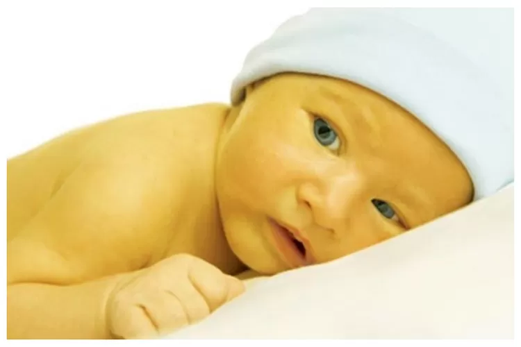 Mengatasi Penyakit Kuning pada Bayi: Tips dan Cara Penting Untuk Ibu